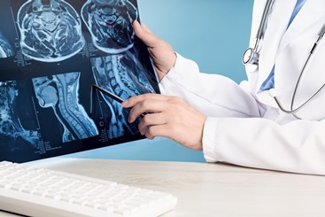Spinal Cord Injuries